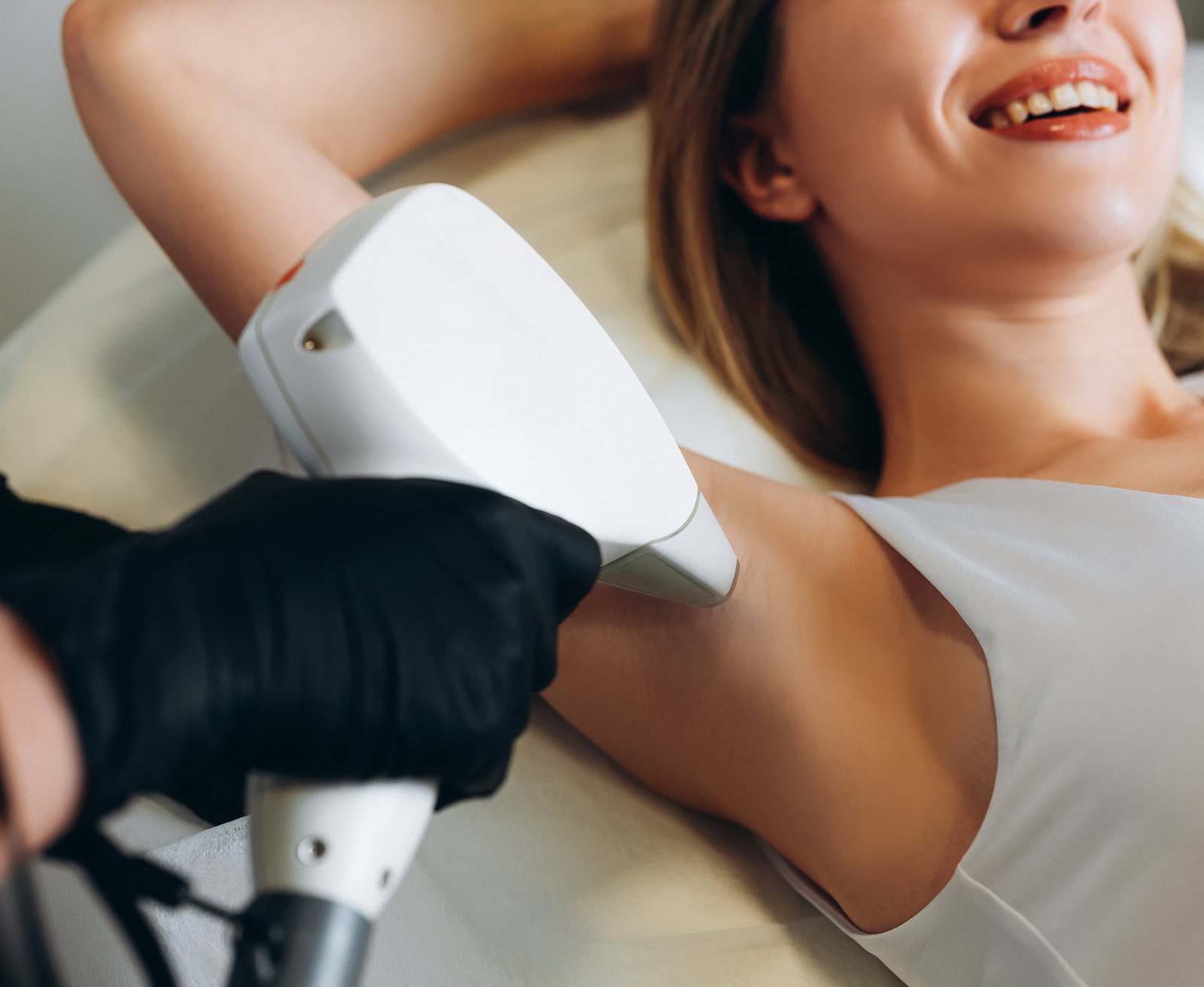 Diode laser hair removal